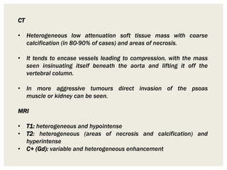 CT
• Heterogeneous low attenuation soft tissue mass with coarse
calcification (in 80-90% of cases) and areas of necrosis.
• It tends to encase vessels leading to compression, with the mass
seen insinuating itself beneath the aorta and lifting it off the
vertebral column.
• In more aggressive tumours direct invasion of the psoas
muscle or kidney can be seen.
MRI
• T1: heterogeneous and hypointense
• T2: heterogeneous (areas of necrosis and calcification) and
hyperintense
• C+ (Gd): variable and heterogeneous enhancement
 