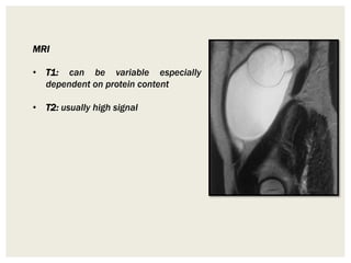 MRI
• T1: can be variable especially
dependent on protein content
• T2: usually high signal
 