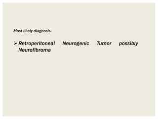 Most likely diagnosis-
Retroperitoneal Neurogenic Tumor possibly
Neurofibroma
 