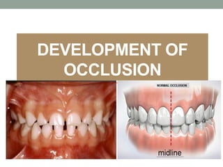 DEVELOPMENT OF
OCCLUSION
 