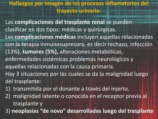 Hallazgos por imagen de los procesos inflamatorios del
trayecto urinario.
Las complicaciones del trasplante renal se pueden
clasificar en dos tipos: médicas y quirúrgicas.
Las complicaciones médicas incluyen aquellas relacionadas
con la terapia inmunosupresora, es decir rechazo, infección
(13%), tumores (5%), alteraciones metabólicas,
enfermedades sistémicas problemas neurológicos y
aquellas relacionadas con la causa primaria.
Hay 3 situaciones por las cuales se da la malignidad luego
del trasplante:
1) transmitida por el donante a través del injerto,
2) malignidad latente o conocida en el receptor previa al
trasplante y
3) neoplasias “de novo” desarrolladas luego del trasplante
 
