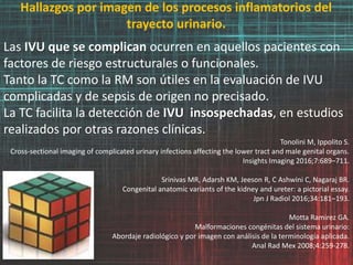 Hallazgos por imagen de los procesos inflamatorios del
trayecto urinario.
Las IVU que se complican ocurren en aquellos pacientes con
factores de riesgo estructurales o funcionales.
Tanto la TC como la RM son útiles en la evaluación de IVU
complicadas y de sepsis de origen no precisado.
La TC facilita la detección de IVU insospechadas, en estudios
realizados por otras razones clínicas.
Tonolini M, Ippolito S.
Cross-sectional imaging of complicated urinary infections affecting the lower tract and male genital organs.
Insights Imaging 2016;7:689–711.
Srinivas MR, Adarsh KM, Jeeson R, C Ashwini C, Nagaraj BR.
Congenital anatomic variants of the kidney and ureter: a pictorial essay.
Jpn J Radiol 2016;34:181–193.
Motta Ramirez GA.
Malformaciones congénitas del sistema urinario:
Abordaje radiológico y por imagen con análisis de la terminología aplicada.
Anal Rad Mex 2008;4:259-278.
 