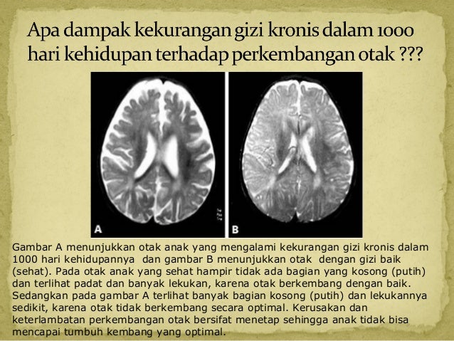 1000 hari dalam kehidupan mar13