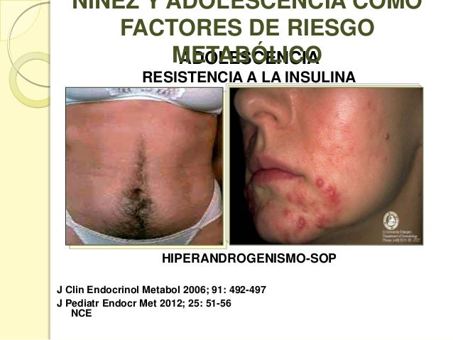Niñez y adolescencia como factores de riesgo metabólico Niñez y adolescencia como factores de riesgo metabólico