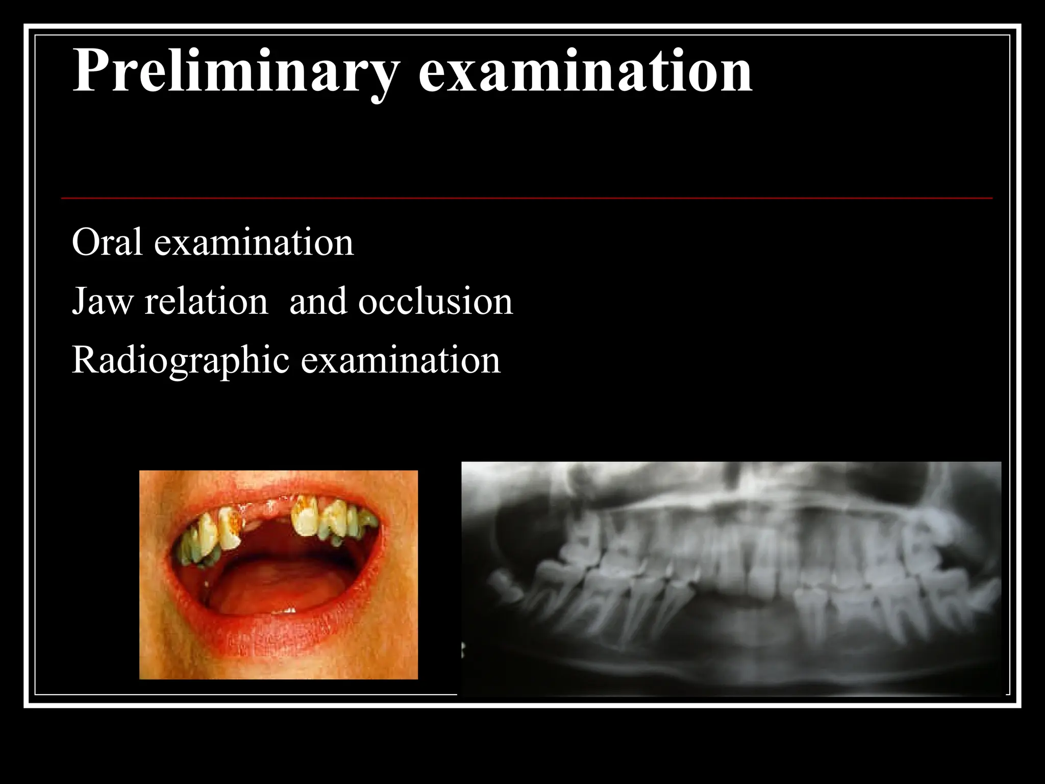 Preliminary examination
Oral examination
Jaw relation and occlusion
Radiographic examination
 