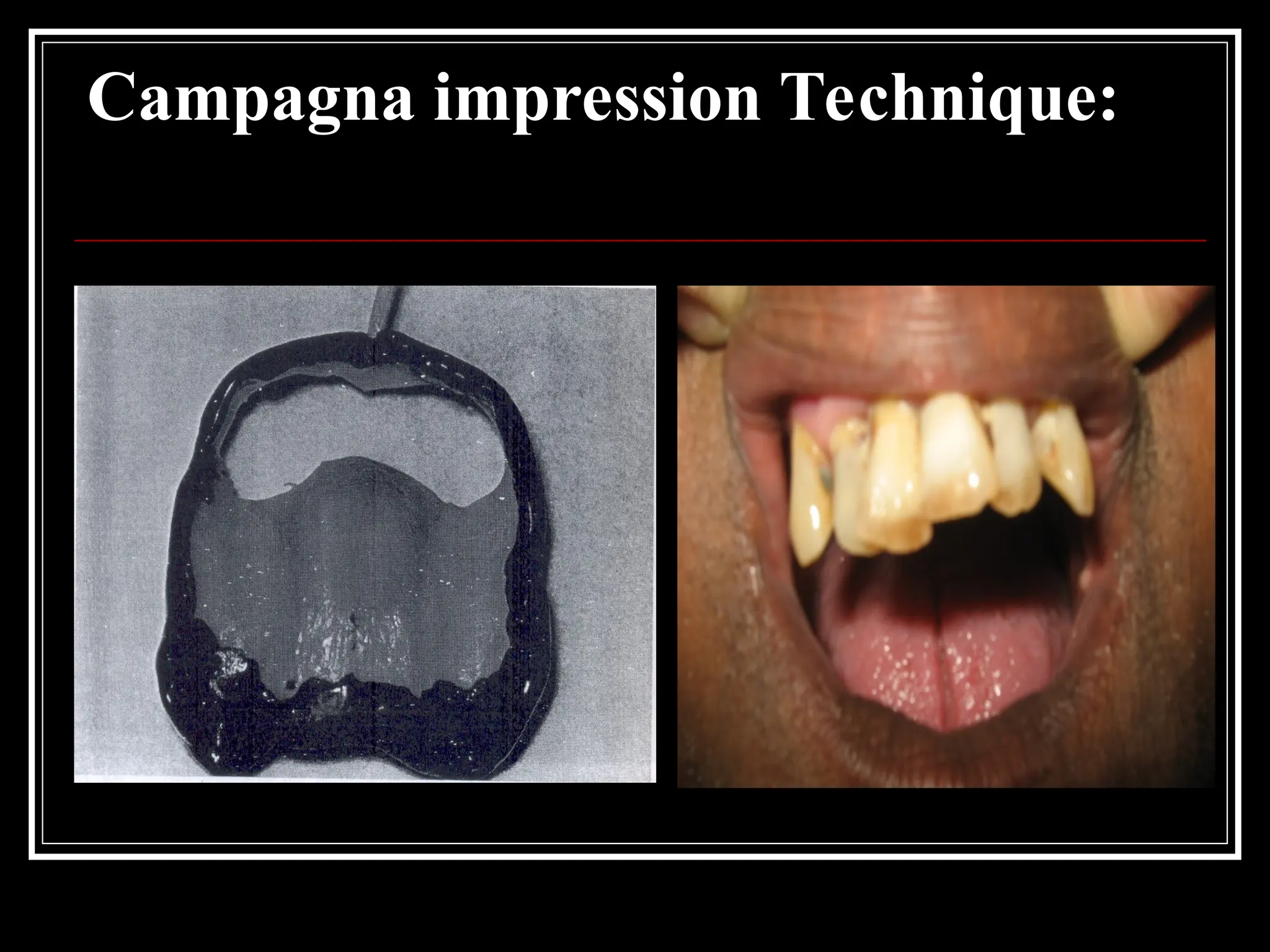 Campagna impression Technique:
 