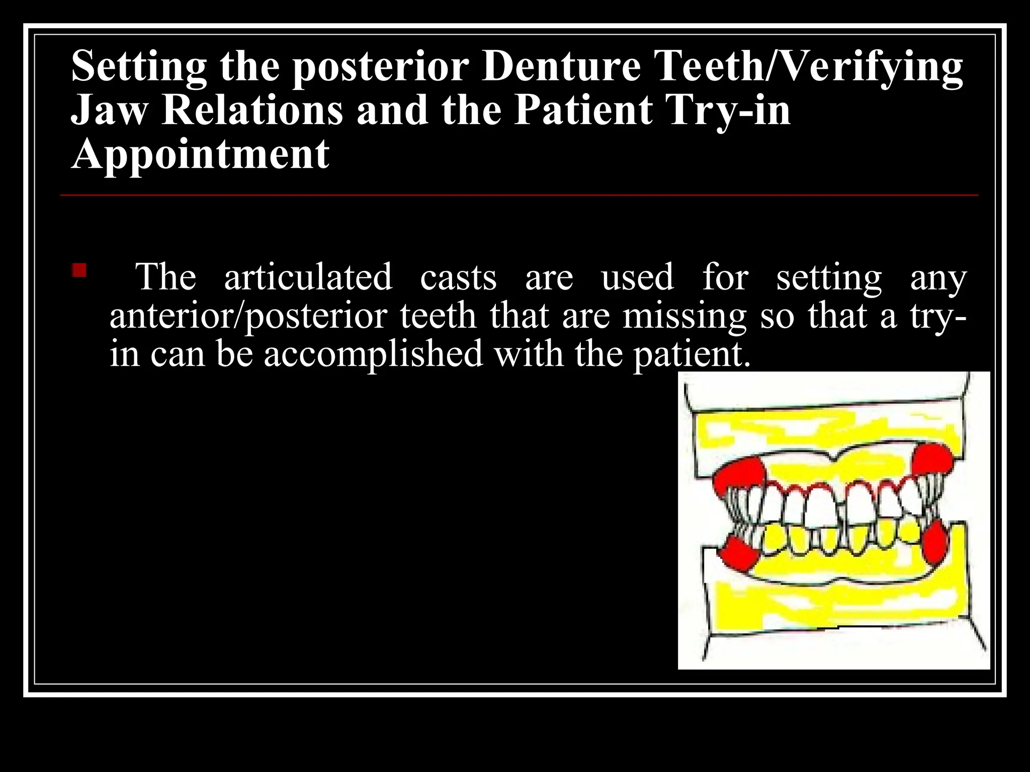 Setting the posterior Denture Teeth/Verifying
Jaw Relations and the Patient Try-in
Appointment
 The articulated casts are used for setting any
anterior/posterior teeth that are missing so that a try-
in can be accomplished with the patient.
 