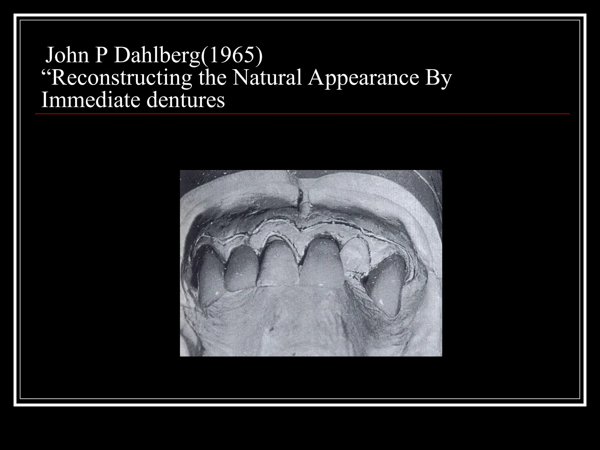 John P Dahlberg(1965)
“Reconstructing the Natural Appearance By
Immediate dentures
 