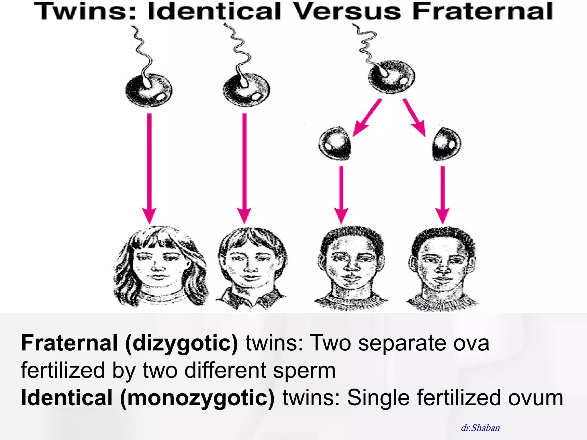 Fraternal (dizygotic) twins: Two separate ova
fertilized by two different sperm
Identical (monozygotic) twins: Single fertilized ovum
                                          dr.Shaban
 