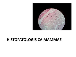 HISTOPATOLOGIS CA MAMMAE
 
