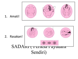 SADARI ( Periksa Payudara
Sendiri)
1. Amati!
2. Rasakan!
 