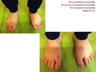 #стопыскажутвамспасибо
#позвоночникскажетвамспасибо
#телоскажетвамспасибо
#прозрение
 