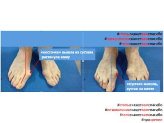 #стопыскажутвамспасибо
#позвоночникскажетвамспасибо
#телоскажетвамспасибо
#прозрение
 