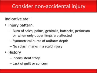 Consider non-accidental injury
Indicative are:
• Injury pattern:
– Burn of soles, palms, genitalia, buttocks, perineum
or when only upper limps are affected
– Symmetrical burns of uniform depth
– No splash marks in a scald injury
• History
– Inconsistent story
– Lack of guilt or concern
 
