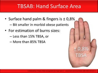 TBSAB: Hand Surface Area
• Surface hand palm & fingers is ± 0,8%
– Bit smaller in morbid obese patients
• For estimation of burns sizes:
– Less than 15% TBSA, or
– More than 85% TBSA
± 0,8%
TBSA
S.Hettiaratchy, R.Papini; Initial management of a major burn: II - assessment and resuscitation; BMJ 2004;329:101–3
 