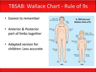 TBSAB: Wallace Chart - Rule of 9s
• Easiest to remember
• Anterior & Posterior
part of limbs together
• Adapted version for
children: Less accurate
 