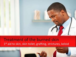 Treatment of the burned skin
1st aid to skin, skin toilet, grafting, strictures, keloid
 