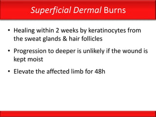 Superficial Dermal Burns
• Healing within 2 weeks by keratinocytes from
the sweat glands & hair follicles
• Progression to deeper is unlikely if the wound is
kept moist
• Elevate the affected limb for 48h
 