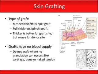 Skin Grafting
• Type of graft:
– Meshed thin/thick split graft
– Full thickness (pinch) graft
– Thicker is better for graft site;
but worse for donor site
• Grafts have no blood supply
– Do not graft where no
granulation can occurs; like
cartilage, bone or naked tendon
 