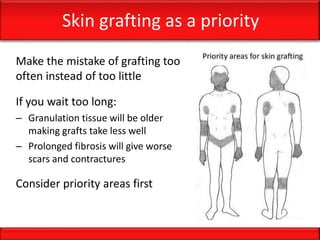 Skin grafting as a priority
Make the mistake of grafting too
often instead of too little
If you wait too long:
– Granulation tissue will be older
making grafts take less well
– Prolonged fibrosis will give worse
scars and contractures
Consider priority areas first
 