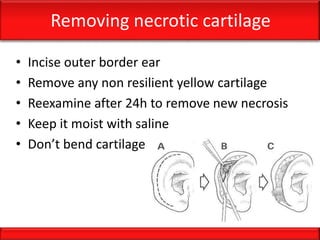 Removing necrotic cartilage
• Incise outer border ear
• Remove any non resilient yellow cartilage
• Reexamine after 24h to remove new necrosis
• Keep it moist with saline
• Don’t bend cartilage
 