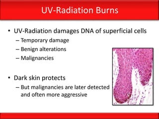 UV-Radiation Burns
• UV-Radiation damages DNA of superficial cells
– Temporary damage
– Benign alterations
– Malignancies
• Dark skin protects
– But malignancies are later detected
and often more aggressive
 