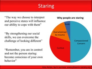Staring
“The way we choose to interpret
and perceive stares will influence
our ability to cope with them”
“By strengthening our social
skills, we can overcome the
challenge of looking different”
“Remember, you are in control
and not the person staring:
become conscious of your own
behavior”
Why people are staring
Compassioned
Concern
Curious
Overwhelmed
by trauma
Rude
Amy Acton, burn survivor, www.phoenix-society.org
 