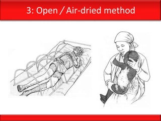 3: Open / Air-dried method
 