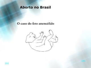 Aborto no Brasil



      O caso do feto anencéfalo




                                  101
101
 