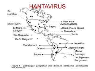 HANTAVIRUS
 