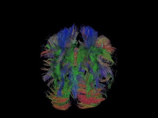 Impact on Health Reform on Device Development and Funding