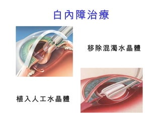 醫學工程概論101 1