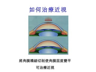 醫學工程概論101 1