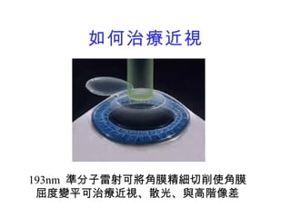 醫學工程概論101 1