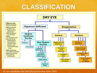 CLASSIFICATION
Dry eye classification flow chart (Dry eye workshop report, 2007)
 