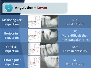 Complicated Extraction and Odontectomy | PPT