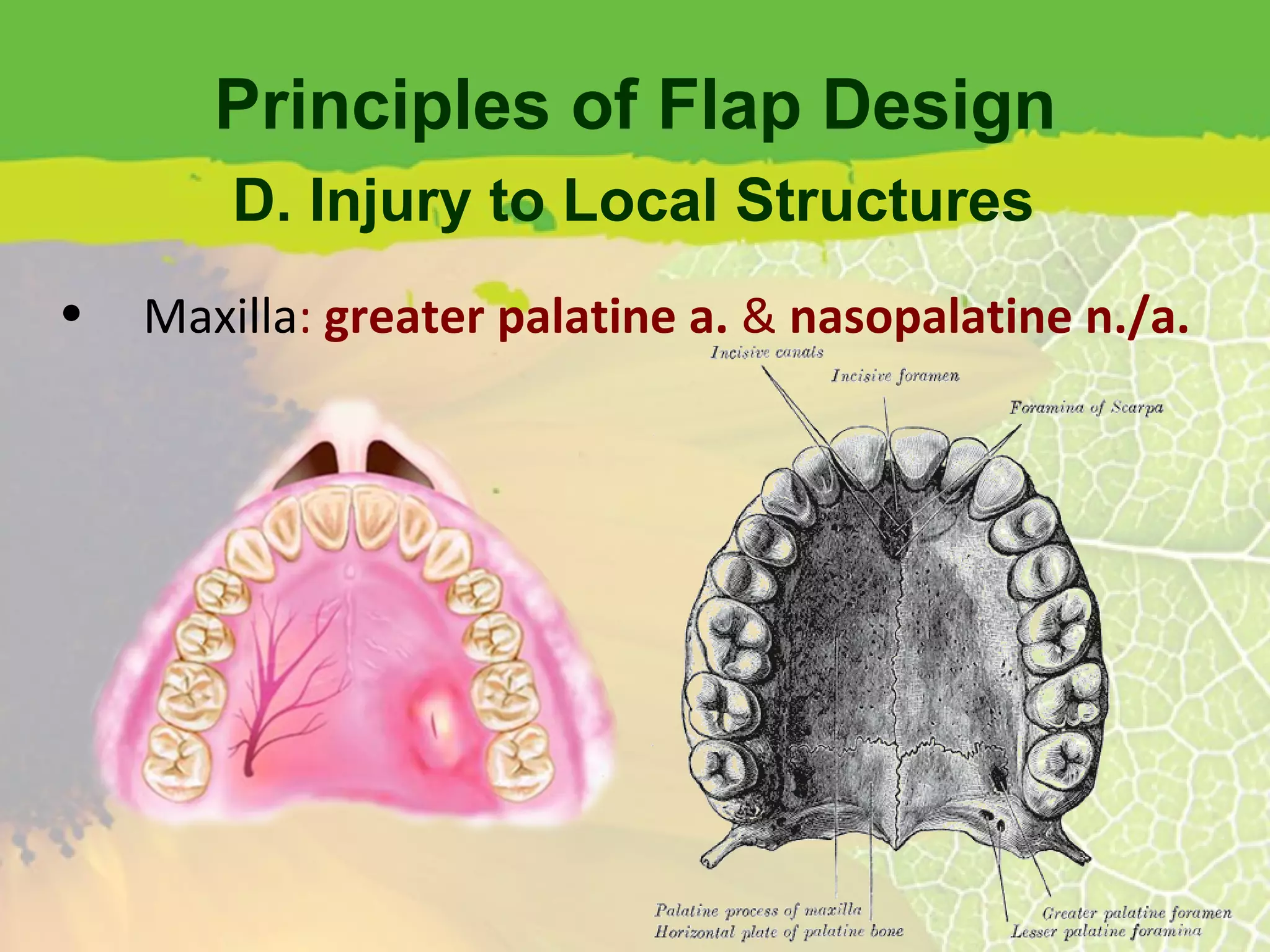 Principles of Flap Design Maxilla :  greater palatine a.  &  nasopalatine n./a. D. Injury to Local Structures 