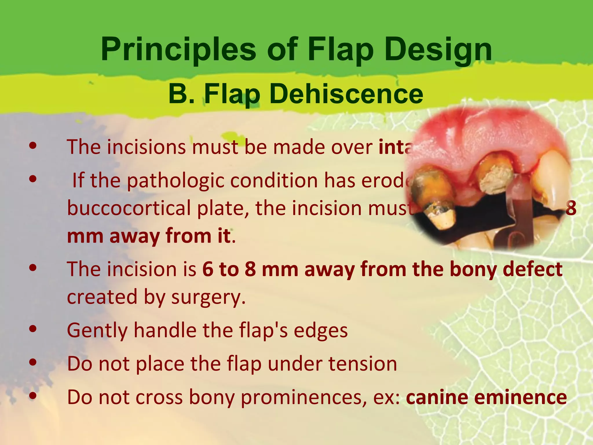 Principles of Flap Design The incisions must be made over  intact bone If the pathologic condition has eroded the buccocortical plate, the incision must be at least  6 or 8 mm away from it . The incision is  6 to 8 mm away from the bony defect  created by surgery. Gently handle the flap's edges Do not place the flap under tension Do not cross bony prominences, ex:  canine eminence B. Flap Dehiscence 