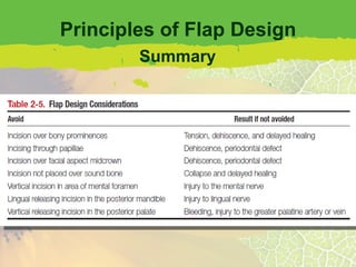Principles of Flap Design Summary 