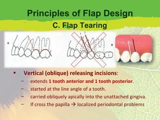 Principles of Flap Design Envelope flaps an incision around the necks of several teeth. extends  2 teeth anterior and 1 tooth posterior . If not provide sufficient access… Vertical (oblique) releasing incisions : extends  1 tooth anterior and 1 tooth posterior . started at the line angle of a tooth. carried obliquely apically into the unattached gingiva. If cross the papilla    localized periodontal problems C. Flap Tearing 