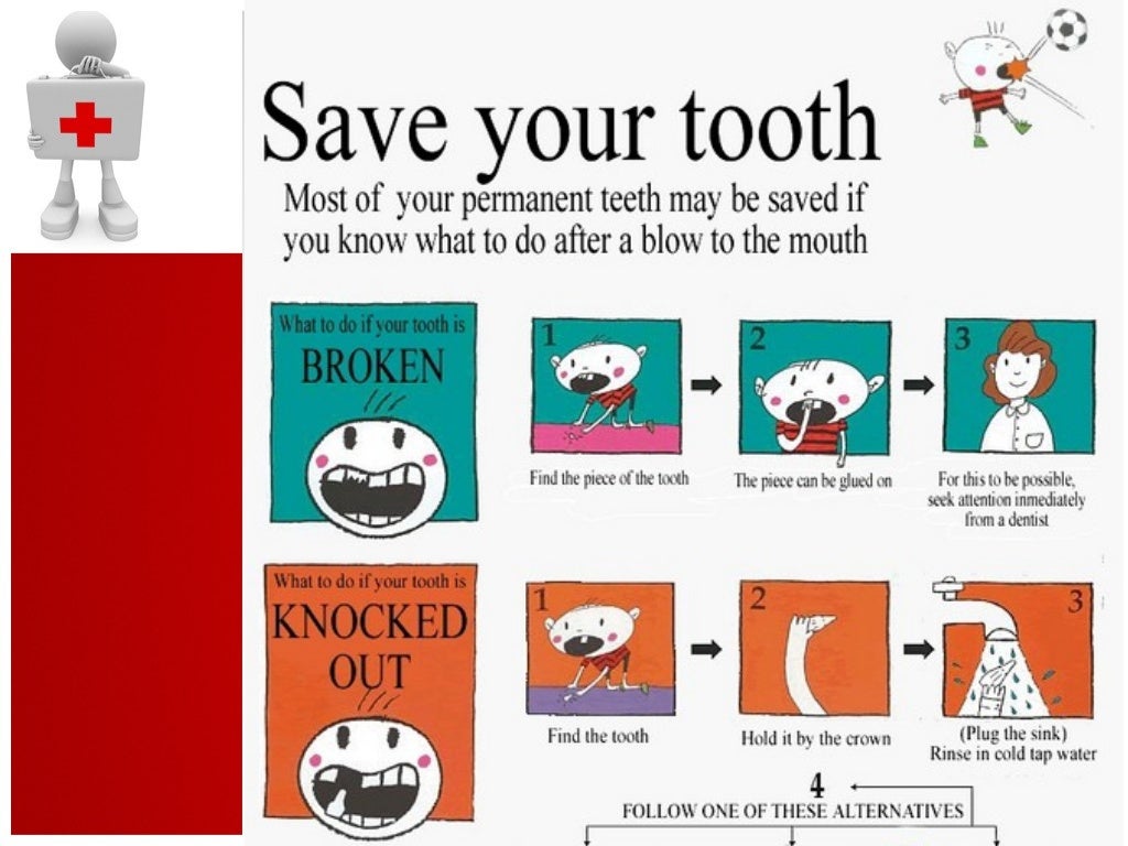 Traumatic Dental Injury and Treatment