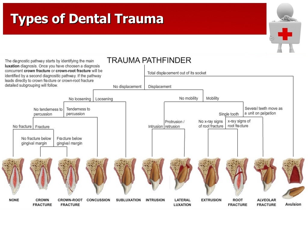 Traumatic Dental Injury and Treatment