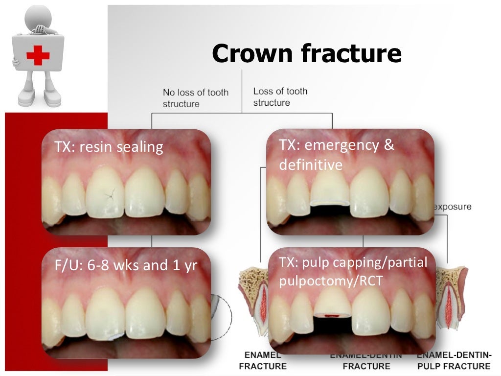 Traumatic Dental Injury and Treatment