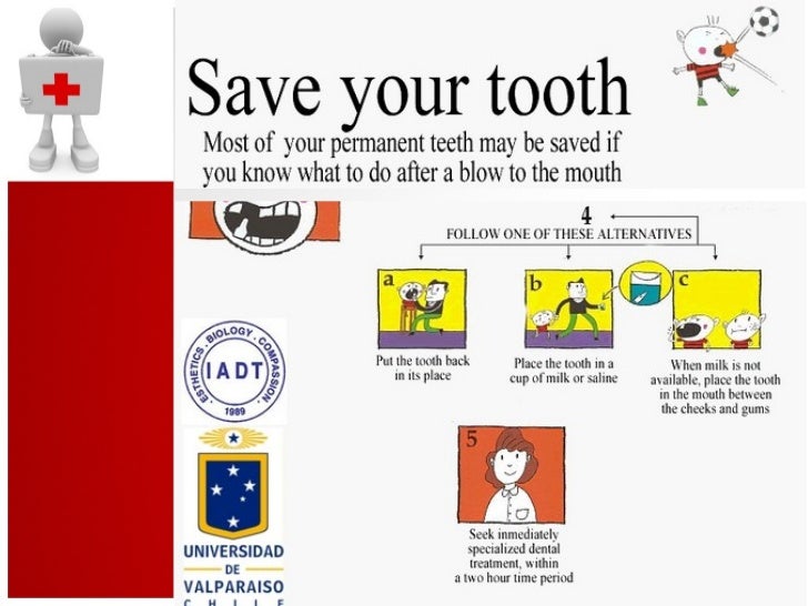 Traumatic Dental Injury and Treatment