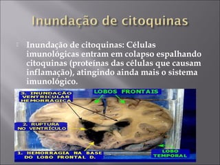  Inundação de citoquinas: Células 
imunológicas entram em colapso espalhando 
citoquinas (proteínas das células que causam 
inflamação), atingindo ainda mais o sistema 
imunológico. 
 