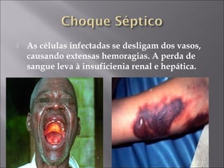  As células infectadas se desligam dos vasos, 
causando extensas hemoragias. A perda de 
sangue leva à insuficienia renal e hepática. 
 