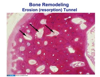 Bone Remodeling Histology