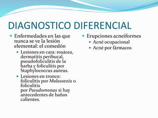 DIAGNOSTICO DIFERENCIAL
 Enfermedades en las que
nunca se ve la lesión
elemental: el comedón
 Lesiones en cara: rosácea,
dermatitis peribucal,
pseudofoliculitis de la
barba y foliculitis por
Staphylococcus aureus.
 Lesiones en tronco:
foliculitis por Malassezia o
foliculitis
por Pseudomonas si hay
antecedentes de baños
calientes.
 Erupciones acneiformes
 Acné ocupacional
 Acné por fármacos
 