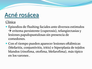 Acné rosácea
Clínica
 Episodios de flushing faciales ante diversos estímulos
 eritema persistente (cuperosis), telangiectasias y
lesiones papulopustulosas sin presencia de
comedones.
 Con el tiempo pueden aparecer lesiones oftálmicas
(blefaritis, conjuntivitis, iritis) e hiperplasia de tejidos
blandos (rinofima, otofima, blefarofima), más típico
en los varones .
 