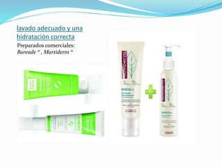 lavado adecuado y una
hidratación correcta
Preparados comerciales:
Boreade ® , Martiderm ®
 